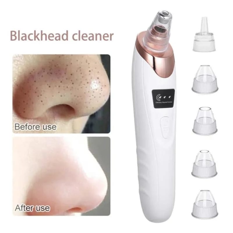 Rechargeable Electric Blackhead Remover Machine